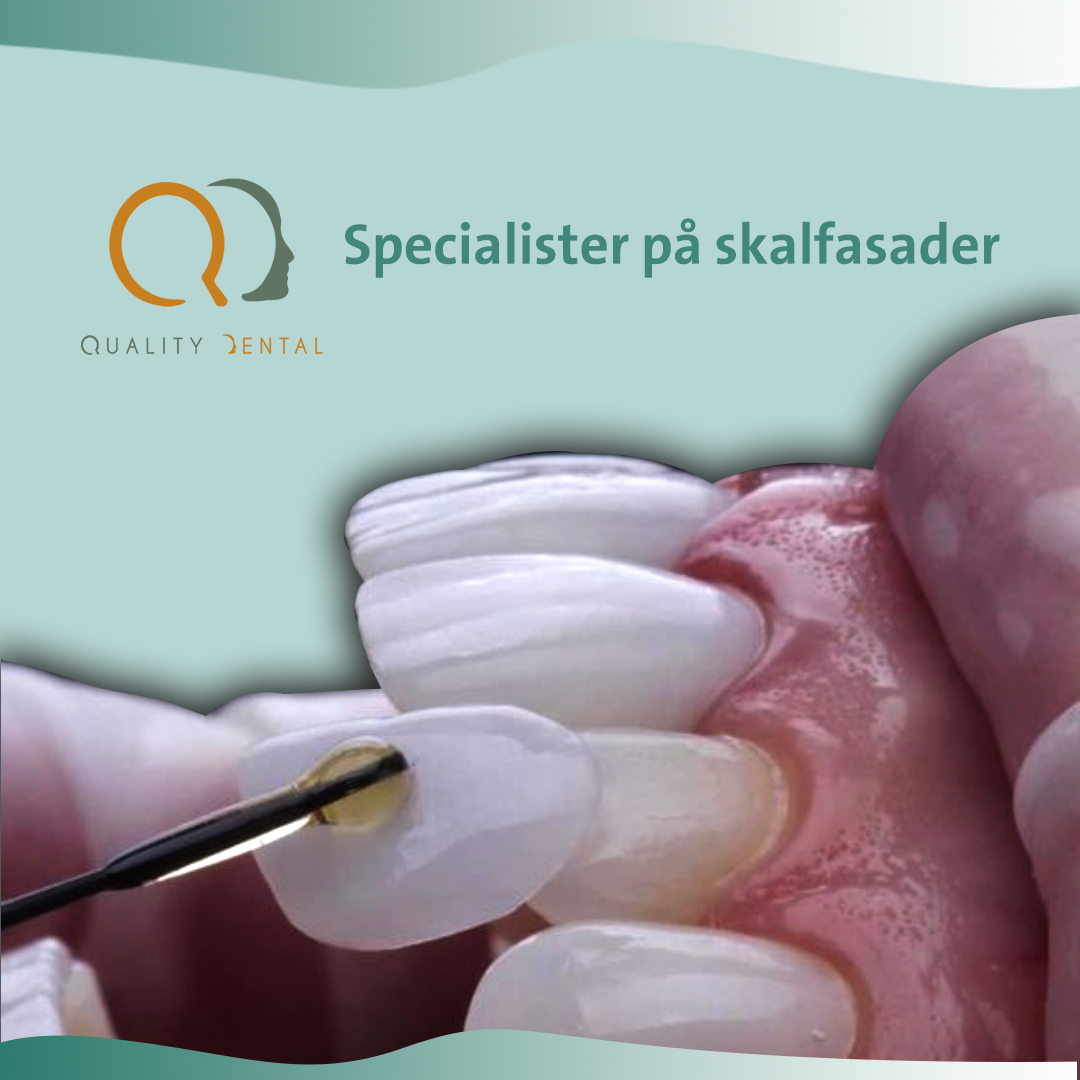 Tandläkare placerar porslinsfasad på tand hos patient i Göteborg